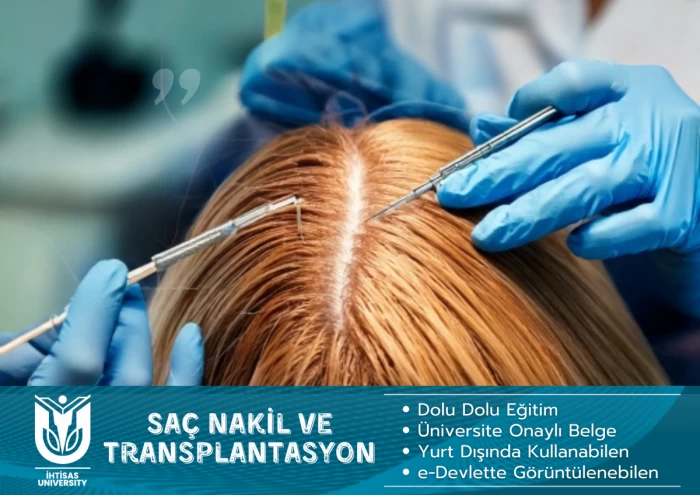 Saç Nakil ve Transplantasyonu-1