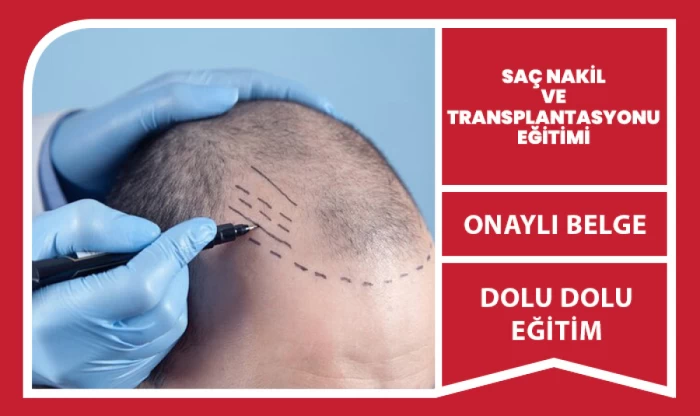 Saç Nakli ve Transplantasyonu
