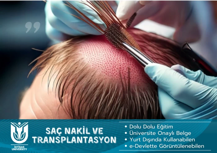 Saç Nakil ve Transplantasyonu-2